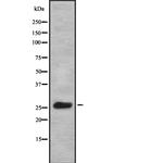 KCNIP1 Polyclonal Antibody
