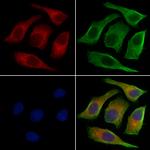 KV3.3 (KCNC3) Polyclonal Antibody