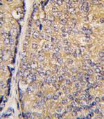 STAP1 Polyclonal Antibody