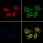 KCNK5 Polyclonal Antibody