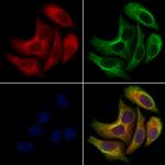 KCNN2 Polyclonal Antibody