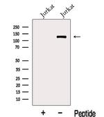 KDM2A Polyclonal Antibody
