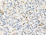 JMJD2A Polyclonal Antibody