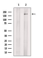 JMJD2C Polyclonal Antibody