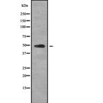 Cytokeratin 23 Polyclonal Antibody