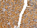 KIAA0701 Antibody in Immunohistochemistry (Paraffin) (IHC (P))