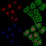 KIF17 Polyclonal Antibody