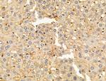 KIR2DL4 Antibody in Immunohistochemistry (Paraffin) (IHC (P))