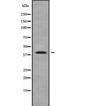 Herpes Simplex Virus Type 1 (strain HFEM) Polyclonal Antibody