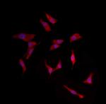 Herpes Simplex Virus Type 1 (strain SC16) Polyclonal Antibody