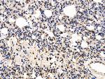 KLF15 Polyclonal Antibody