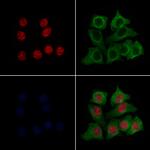 KLF5 Polyclonal Antibody