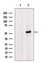 KLF5 Antibody in Western Blot (WB)