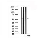 KLF5 Antibody in Western Blot (WB)