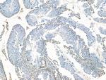 SETDB1 Polyclonal Antibody