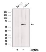 KPNA5 Antibody in Western Blot (WB)