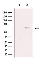 KV1.6 (KCNA6) Polyclonal Antibody