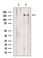 LRRC7 Antibody in Western Blot (WB)