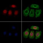 LAP2 Polyclonal Antibody