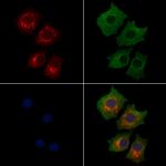 LARS2 Polyclonal Antibody