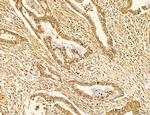 LARS2 Antibody in Immunohistochemistry (Paraffin) (IHC (P))
