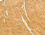 LARS2 Antibody in Immunohistochemistry (Paraffin) (IHC (P))
