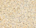 LARS2 Antibody in Immunohistochemistry (Paraffin) (IHC (P))
