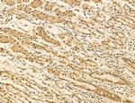 LARS2 Antibody in Immunohistochemistry (Paraffin) (IHC (P))
