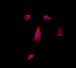 LATS1/LATS2 Polyclonal Antibody