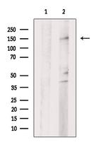 LATS2 Polyclonal Antibody