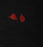 LC3A/LC3B Polyclonal Antibody