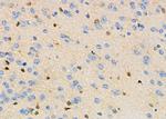 LC3B Antibody in Immunohistochemistry (Paraffin) (IHC (P))