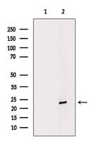 NGAL Antibody in Western Blot (WB)