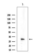 NGAL Antibody in Western Blot (WB)