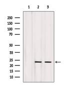 NGAL Polyclonal Antibody
