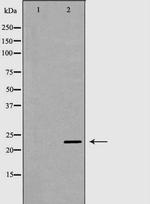 NGAL Polyclonal Antibody