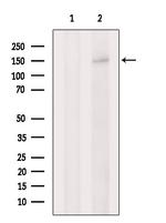 LDLR Antibody in Western Blot (WB)