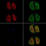 LHR Polyclonal Antibody