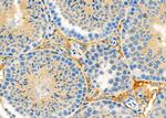 LHR Antibody in Immunohistochemistry (Paraffin) (IHC (P))