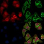 LIMK1 Polyclonal Antibody