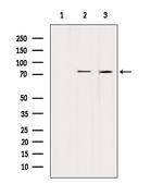 LIMK2 Polyclonal Antibody