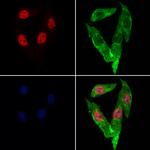 Lamin B2 Polyclonal Antibody