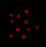 Lamin B2 Antibody in Immunocytochemistry (ICC/IF)