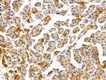 LMX1A Antibody in Immunohistochemistry (Paraffin) (IHC (P))