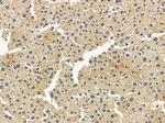 LSS Polyclonal Antibody