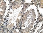 LY6K Polyclonal Antibody