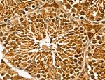 LZTFL1 Antibody in Immunohistochemistry (Paraffin) (IHC (P))