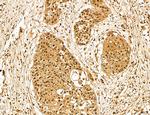 LZTFL1 Antibody in Immunohistochemistry (Paraffin) (IHC (P))