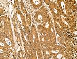 LZTFL1 Antibody in Immunohistochemistry (Paraffin) (IHC (P))