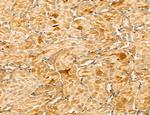 LZTFL1 Antibody in Immunohistochemistry (Paraffin) (IHC (P))